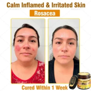 Raindew® Bee Venom Repair Cream