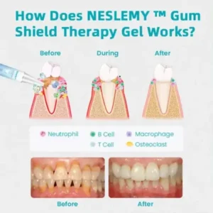 NESLEMY™ Gum Shield Therapy Gel