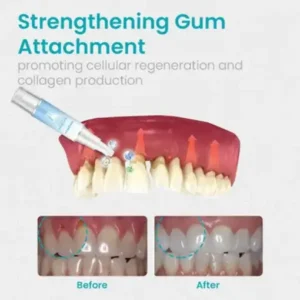 NESLEMY™ Gum Shield Therapy Gel